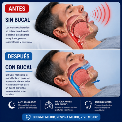 Férula bucal antironquídos