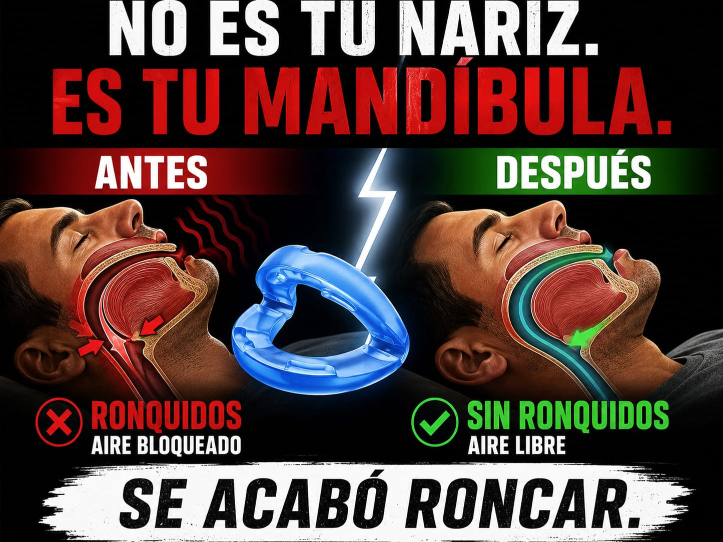 Férula bucal antironquídos